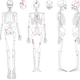 Red marks indicate distribution of injuries.